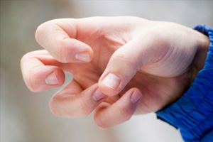 Лечение эпилепсии