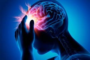 Генерализованная идиопатическая эпилепсия