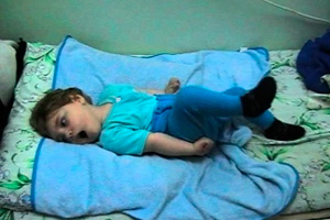 Признаки эпилепсии у детей